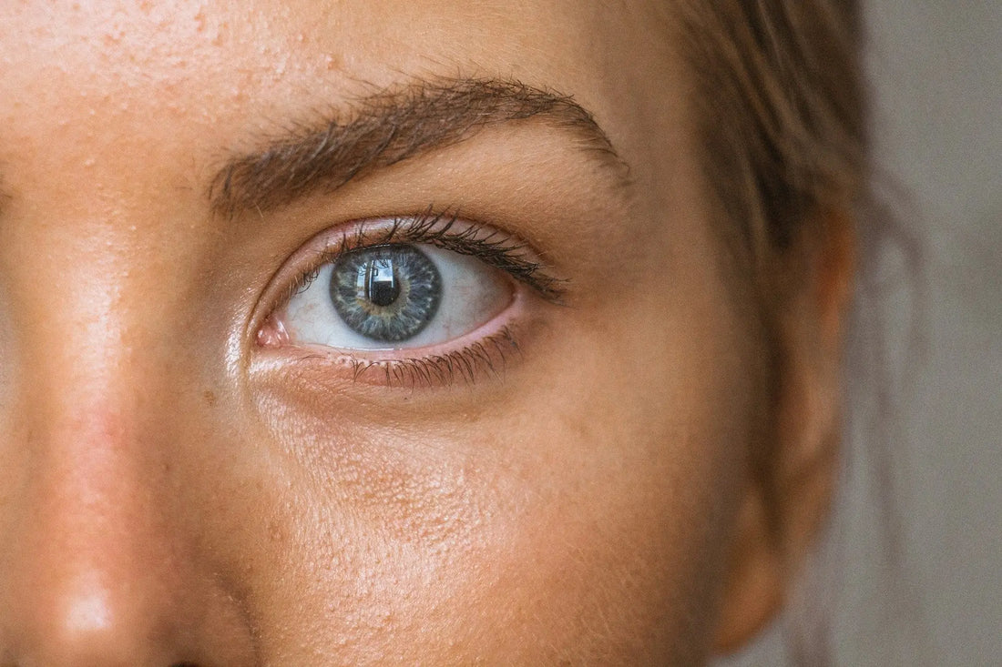 Can Collagen Cause Acne?