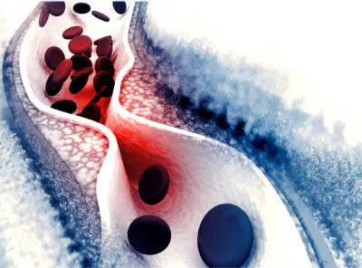 Illustration showing cholesterol in the bloodstream with red blood cells and artery structure, representing LDL and HDL balance